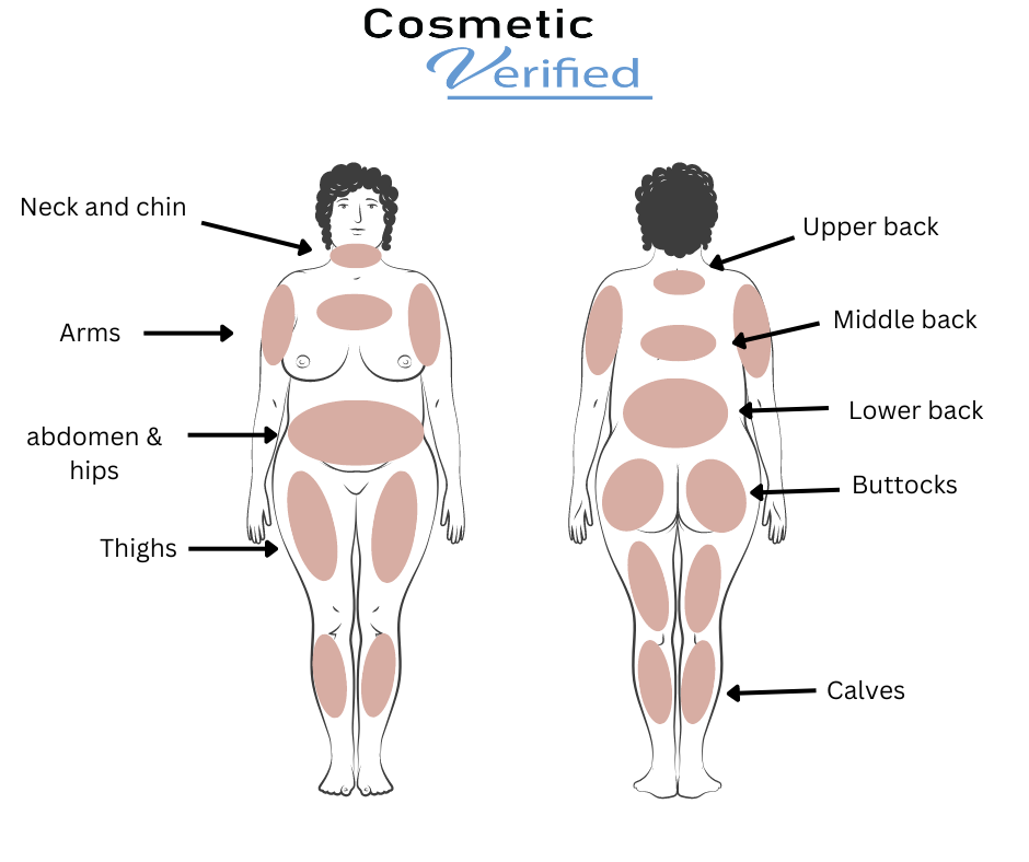 Liposuction body illustration